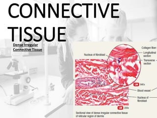CONNECTIVE
TISSUEDense Irregular
Connective Tissue
 