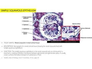 SIMPLE SQUAMOUS EPITHELIUM
• TISSUE SAMPLE: Renal corpuscle in renal cortical tissue
• DESCRIPTION: Micrograph of a renal cortical tissue showing the renal corpuscle lined with
simple squamous epithelium.
• FUNCTION: The simple squamous epithelium in the renal corpuscle acts as a lining which is
essential in creating a filtration membrane between glomerulus and glomerular space. It usually
covers surfaces that allow transport of substances or fluid.
• SOURCE: Atlas of Histology, Victor P. Eroschenko, 13th ed., page 129
MAGNIFICATION: 120 x I STAIN: Masson trichome
Apical surface
Nucleus (flattened)
Basement membrane
 