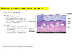• Click to add subtitle
STRATIFIED SQUAMOUS KERATINIZED EPITHELIUM
• TISSUE SAMPLE: Palm of Hands
• DESCRIPTION:
 from many layers, with the less
differentiated cuboidal cells near the
basement membrane. They become
more irregular in shape and then flatten
as they accumulate keratin
• FUNCTION:
 keratin on the surface layer of the tissue
helps protect against water loss across
the epithelium
 protection against easy invasion of
underlying tissue by microorganisms MAGNIFICATION: X 40 I STAIN: Hematoxylin and Eosin
Reference: diFiore’s Atlas of Histology with Functional Correlation 11th ed. p. 61
 