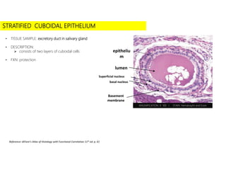 • Click to add subtitle
STRATIFIED CUBOIDAL EPITHELIUM
• TISSUE SAMPLE: excretory duct in salivary gland
• DESCRIPTION:
 consists of two layers of cuboidal cells
• FXN: protection
Reference: diFiore’s Atlas of Histology with Functional Correlation 11th ed. p. 61
MAGNIFICATION: X 100 I STAIN: Hematoxylin and Eosin
epitheliu
m
lumen
Basement
membrane
Superficial nucleus
basal nucleus
 