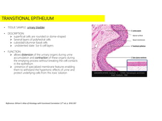 • Click to add subtitle
TRANSITIONAL EPITHELIUM
• TISSUE SAMPLE: urinary bladder
• DESCRIPTION:
 superficial cells are rounded or dome-shaped
 Several layers of polyhedral cells
 cuboidal/columnar basal cells
 undistented state: 5or 6 cell layers
• FUNCTION:
 allows distension of the urinary organs during urine
accumulation and contraction of these organs during
the emptying process without breaking the cell contacts
in the epithelium
 presence of specialized membrane features enabling
them to withstand the hypertonic effects of urine and
protect underlying cells from this toxic solution
Reference: DiFiore’s Atlas of Histology with Functional Correlation 11th ed. p. 39 & 397
MAGNIFICATION: medium I STAIN: Hematoxylin and Eosin
Inset: medium, H&E
Basal membrane
Apical surface
 