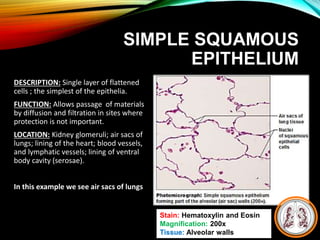 SIMPLE SQUAMOUS
EPITHELIUM
DESCRIPTION: Single layer of flattened
cells ; the simplest of the epithelia.
FUNCTION: Allows passage of materials
by diffusion and filtration in sites where
protection is not important.
LOCATION: Kidney glomeruli; air sacs of
lungs; lining of the heart; blood vessels,
and lymphatic vessels; lining of ventral
body cavity (serosae).
In this example we see air sacs of lungs
Stain: Hematoxylin and Eosin
Magnification: 200x
Tissue: Alveolar walls
 