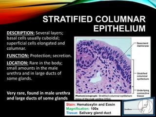 STRATIFIED COLUMNAR
EPITHELIUMDESCRIPTION: Several layers;
basal cells usually cuboidal;
superficial cells elongated and
columnar.
FUNCTION: Protection; secretion.
LOCATION: Rare in the body;
small amounts in the male
urethra and in large ducts of
some glands.
Very rare, found in male urethra
and large ducts of some glands
Stain: Hematoxylin and Eosin
Magnification: 100x
Tissue: Salivary gland duct
 