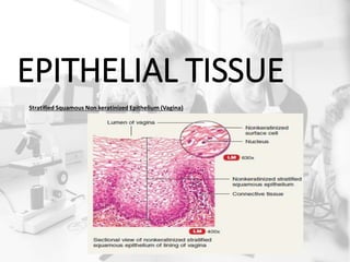 EPITHELIAL TISSUE
Stratified Squamous Non keratinized Epithelium (Vagina)
 
