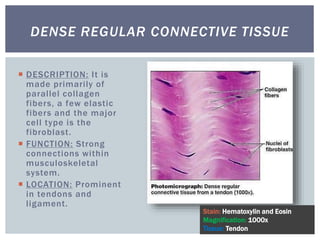  DESCRIPTION: It is
made primarily of
parallel collagen
fibers, a few elastic
fibers and the major
cell type is the
fibroblast.
 FUNCTION: Strong
connections within
musculoskeletal
system.
 LOCATION: Prominent
in tendons and
ligament.
DENSE REGULAR CONNECTIVE TISSUE
Stain: Hematoxylin and Eosin
Magnification: 1000x
Tissue: Tendon
 