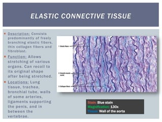  Description: Consists
predominantly of freely
branching elastic fibers,
thin collagen fibers and
fibroblast.
 Function: Allows
stretching of various
organs. Can recoil to
its original shape
after being stretched.
 Locations: Lung
tissue, trachea,
bronchial tube, walls
of some arteries,
ligaments supporting
the penis, and in
between the
vertebrae.
ELASTIC CONNECTIVE TISSUE
Stain: Blue stain
Magnification: 130x
Tissue: Wall of the aorta
 