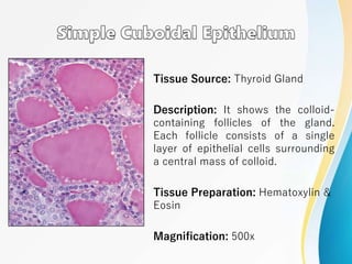 Tissue Source: Thyroid Gland
Description: It shows the colloid-
containing follicles of the gland.
Each follicle consists of a single
layer of epithelial cells surrounding
a central mass of colloid.
Tissue Preparation: Hematoxylin &
Eosin
Magnification: 500x
 