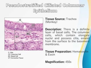 Tissue Source: Trachea
(Monkey)
Description: There is a definite
layer of basal cells. The columnar
cells, which contain elongate
nuclei and possess cilia, extend
from the surface to the basement
membrane.
Tissue Preparation: Hematoxylin
& Eosin
Magnification: 450x
C: Cilia
CC: Columnar Cell
BC: Basal Cell
CT: Connective Tissue
 