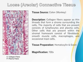 Tissue Source: Colon (Monkey)
Description: Collagen fibers appear as thin
threads that form a stroma surrounding the
cells. The majority of cells that are present
consists of lymphocytes and plasma cells.
Other cells that are present within the
stromal framework consist of fibroblasts,
smooth muscle cells, macrophages, and
occasional mast cells.
Tissue Preparation: Hematoxylin & Eosin
Magnification: 700x
C: Collagen Fibers
P: Plasma Fibers
 