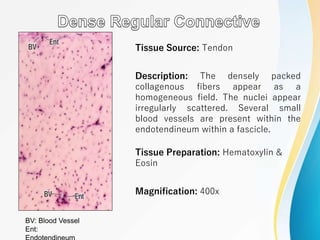 Tissue Source: Tendon
Description: The densely packed
collagenous fibers appear as a
homogeneous field. The nuclei appear
irregularly scattered. Several small
blood vessels are present within the
endotendineum within a fascicle.
Tissue Preparation: Hematoxylin &
Eosin
Magnification: 400x
BV: Blood Vessel
Ent:
 