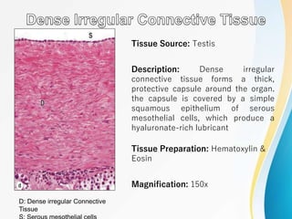 Tissue Source: Testis
Description: Dense irregular
connective tissue forms a thick,
protective capsule around the organ.
the capsule is covered by a simple
squamous epithelium of serous
mesothelial cells, which produce a
hyaluronate-rich lubricant
Tissue Preparation: Hematoxylin &
Eosin
Magnification: 150x
D: Dense irregular Connective
Tissue
 
