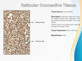 Tissue Source: Lymph Node
Description: Reticular fibers are seen
as irregular black lines. Reticular cells
are heavily stained and dark. The more
lightly
stained cells are lymphocytes passing
through the lymph node.
Tissue Preparation: Silver staining
Magnification: 200x
Reticular fibers
Reticular cells
 