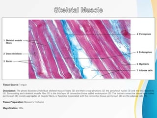 Tissue Source: Tongue
Description: The photo illustrates individual skeletal muscle fibers (1) and their cross-striations (2) the peripheral nuclei (3) and the tiny myofibrils
(6). Surrounding each skeletal muscle fiber (1) is the thin layer of connective tissue called endomysium (5). The thicker connective tissue layer called
perimysium (4) invests aggregates of muscle fibers, or fascicles. Associated with the connective tissue perimysium (4) are the adipose cells (7).
Tissue Preparation: Masson’s Trichome
Magnification: 130x
 