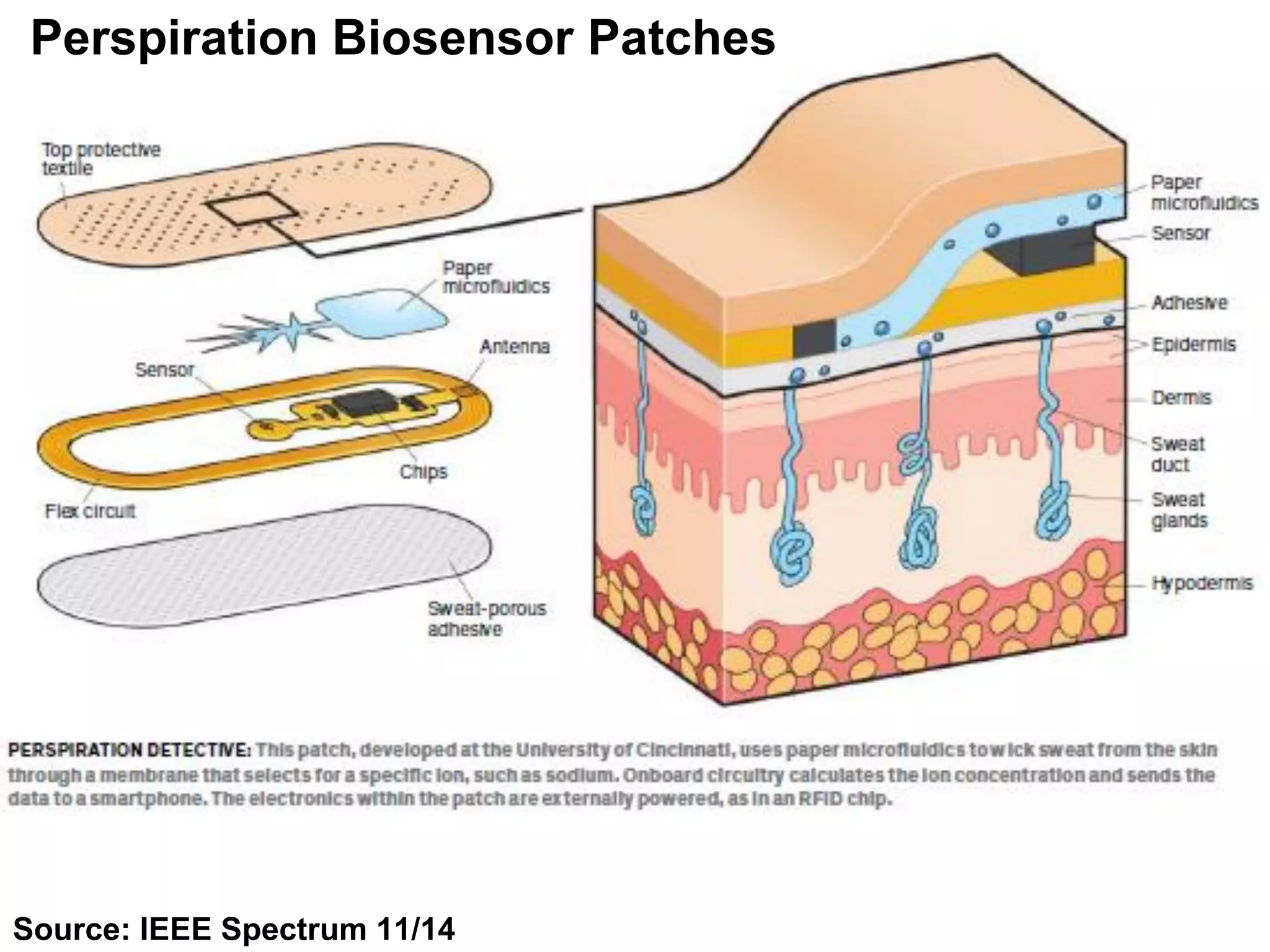 Source: IEEE Spectrum 11/14
Perspiration Biosensor Patches
 