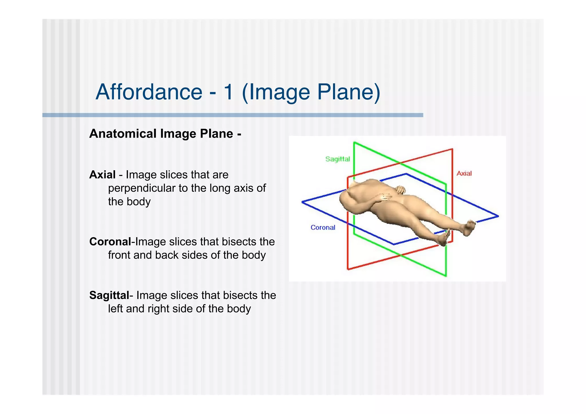 Affordance - 1 (Image Plane)
Anatomical Image Plane -


Axial - Image slices that are
   perpendicular to the long axis of
   the body


Coronal-Image slices that bisects the
   front and back sides of the body


Sagittal- Image slices that bisects the
   left and right side of the body
 