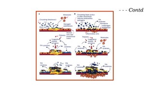 Endocarditis Animation Infective Endocarditis presentation.pptx