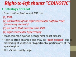 Right-to-left shunts “CYANOTIC”
1. Tetralogy of Fallot
• Four cardinal features of TOF are
(1) VSD
(2) obstruction of the right ventricular outflow tract
(pulmonary stenosis)
(3) an aorta that overrides the VSD
(4) right ventricular hypertrophy
• Most common cyanotic congenital heart disease
• Heart is often enlarged and may be "boot-shaped" due to
marked right ventricular hypertrophy, particularly of the
apical region.
• The VSD is usually large
 