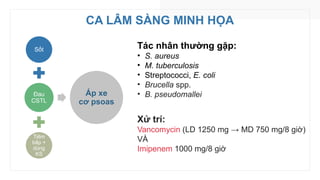 CA LÂM SÀNG MINH HỌA
Sốt
Đau
CSTL
Tiêm
bắp +
dùng
KS
Áp xe
cơ psoas
Tác nhân thường gặp:
• S. aureus
• M. tuberculosis
• Streptococci, E. coli
• Brucella spp.
• B. pseudomallei
Xử trí:
Vancomycin (LD 1250 mg → MD 750 mg/8 giờ)
VÀ
Imipenem 1000 mg/8 giờ
 