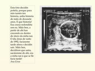 Esta foto decidín poñela, porque para min tamén ten historia, unha historia de máis de dezasete anos. E que historia! Esa cousa redondiña son eu. Máis ben, a partir de ahí fun crecendo eu dentro do útero da miña nai. O día dous de xuño de 1992, facíaseme tarde afora e decidín sair. Máis ben, decidiron que saíra, sacáronme de ahí, era a miña nai á que se lle facía tarde! Ana Eirea 