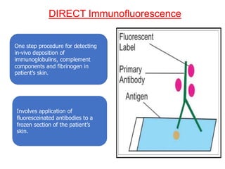DIRECT Immunofluorescence
One step procedure for detecting
in-vivo deposition of
immunoglobulins, complement
components and fibrinogen in
patient’s skin.
Involves application of
fluoresceinated antibodies to a
frozen section of the patient’s
skin.
 