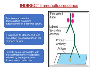 INDIRECT Immunofluorescence
Two step procedure for
demonstrating circulating
autoantibodies in a patient’s serum.
It is utilised to identify and titer
circulating autoantibodies in the
patient’s serum.
Patient’s serum is incubated with
the substrate(monkey esophagus)
followed by the application of
fluoresceinated antibodies.
 