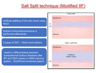 Salt Split technique (Modified IIF)
Artificial splitting of the skin done using
NaCl.
Indirect Immunofluorescence is
performed afterwards.
2 types of SST – Direct and Indirect.
Useful in differentiating between
subepidermal bullous diseases (like
BP and EBA) based on BMZ staining
pattern : Roof/Floor/combined pattern
 