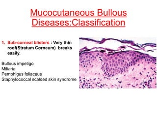Mucocutaneous Bullous
Diseases:Classification
1. Sub-corneal blisters : Very thin
roof(Stratum Corneum) breaks
easily.
Bullous impetigo
Miliaria
Pemphigus foliaceus
Staphylococcal scalded skin syndrome
 