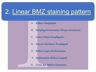 2. Linear BMZ staining pattern
 