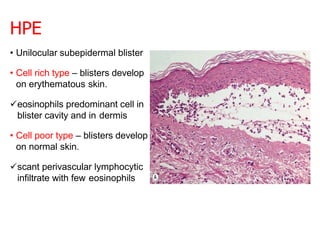 HPE
• Unilocular subepidermal blister
• Cell rich type – blisters develop
on erythematous skin.
eosinophils predominant cell in
blister cavity and in dermis
• Cell poor type – blisters develop
on normal skin.
scant perivascular lymphocytic
infiltrate with few eosinophils
 