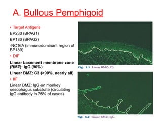 A. Bullous Pemphigoid
• Target Antigens
BP230 (BPAG1)
BP180 (BPAG2)
-NC16A (immunodominant region of
BP180)
• DIF
Linear basement membrane zone
(BMZ): IgG (90%)
Linear BMZ: C3 (>90%, nearly all)
• IIF
Linear BMZ: IgG on monkey
oesophagus substrate (circulating
IgG antibody in 75% of cases)
 