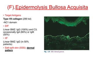 (F).Epidermolysis Bullosa Acquisita
• Target Antigens
Type VII collagen (290 kd)
-NC1 domain
• DIF
Linear BMZ: IgG (100%) and C3;
occasionally IgA (66%) or IgM
(50%)
• IIF
Linear BMZ: IgG (in 50%
patients)
• Salt-split skin (SSS): dermal
pattern
 
