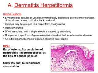 A. Dermatitis Herpetiformis
Clinical Features
• Erythematous papules or vesicles symmetrically distributed over extensor surfaces
of the elbows, knees, buttocks, back, and scalp
• Vesicles may be grouped in a herpetiform configuration
• Intensely pruritic
• Often associated with multiple erosions caused by scratching
• One part of a spectrum of gluten-sensitive disorders that includes celiac disease
• An indirect consequence of a gluten-sensitive enteropathy
HPE:
Early lesions: Accumulation of
neutrophils (microabscesses) at
the tips of dermal papillae.
Older lesions: Subepidermal
vesiculation
 