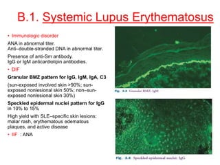 B.1. Systemic Lupus Erythematosus
• Immunologic disorder
ANA in abnormal titer.
Anti–double-stranded DNA in abnormal titer.
Presence of anti-Sm antibody.
IgG or IgM anticardiolipin antibodies.
• DIF
Granular BMZ pattern for IgG, IgM, IgA, C3
(sun-exposed involved skin >90%; sun-
exposed nonlesional skin 50%; non–sun-
exposed nonlesional skin 30%)
Speckled epidermal nuclei pattern for IgG
in 10% to 15%
High yield with SLE–specific skin lesions:
malar rash, erythematous edematous
plaques, and active disease
• IIF : ANA
 