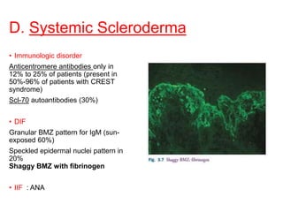 D. Systemic Scleroderma
• Immunologic disorder
Anticentromere antibodies only in
12% to 25% of patients (present in
50%-96% of patients with CREST
syndrome)
Scl-70 autoantibodies (30%)
• DIF
Granular BMZ pattern for IgM (sun-
exposed 60%)
Speckled epidermal nuclei pattern in
20%
Shaggy BMZ with fibrinogen
• IIF : ANA
 