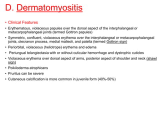 D. Dermatomyositis
• Clinical Features
• Erythematous, violaceous papules over the dorsal aspect of the interphalangeal or
metacarpophalangeal joints (termed Gottron papules)
• Symmetric, confluent, violaceous erythema over the interphalangeal or metacarpophalangeal
joints, olecranon process, medial malleoli, and patella (termed Gottron sign)
• Periorbital, violaceous (heliotrope) erythema and edema
• Periungual telangiectasia with or without cuticular hemorrhage and dystrophic cuticles
• Violaceous erythema over dorsal aspect of arms, posterior aspect of shoulder and neck (shawl
sign)
• Poikiloderma atrophicans
• Pruritus can be severe
• Cutaneous calcification is more common in juvenile form (40%-50%)
 