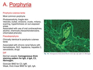 A. Porphyria
Porphyria cutanea tarda
Most common porphyria
Photosensitivity, fragile skin
Vesicles, bullae, erosions, crusts, miliaria,
scarring, hypertrichosis on sun-exposed
areas
Associated with use of oral contraceptives,
alcohol, chemicals (hexachlorobenzene,
chlorinated phenols)
Pseudoporphyria
Clinically identical to porphyria cutanea
tarda
Associated with chronic renal failure with
hemodialysis, SLE, hepatoma, hepatitis C,
sarcoidosis, drugs
DIF
Dermal vessels: homogeneous thick
staining pattern for IgG, ± IgA, C3,
fibrinogen.
Granular BMZ for C3, IgM.
Weak, thick linear BMZ for IgG, IgA.
 