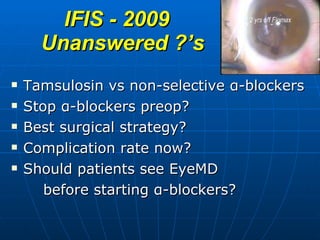 IFIS - 2009  Unanswered ?’s Tamsulosin vs non-selective  α -blockers Stop  α -blockers preop?  Best surgical strategy? Complication rate now? Should patients see EyeMD before starting  α -blockers?  