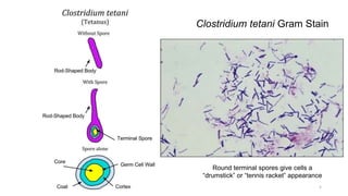 Tetanus in orthopedics and overview.pptx