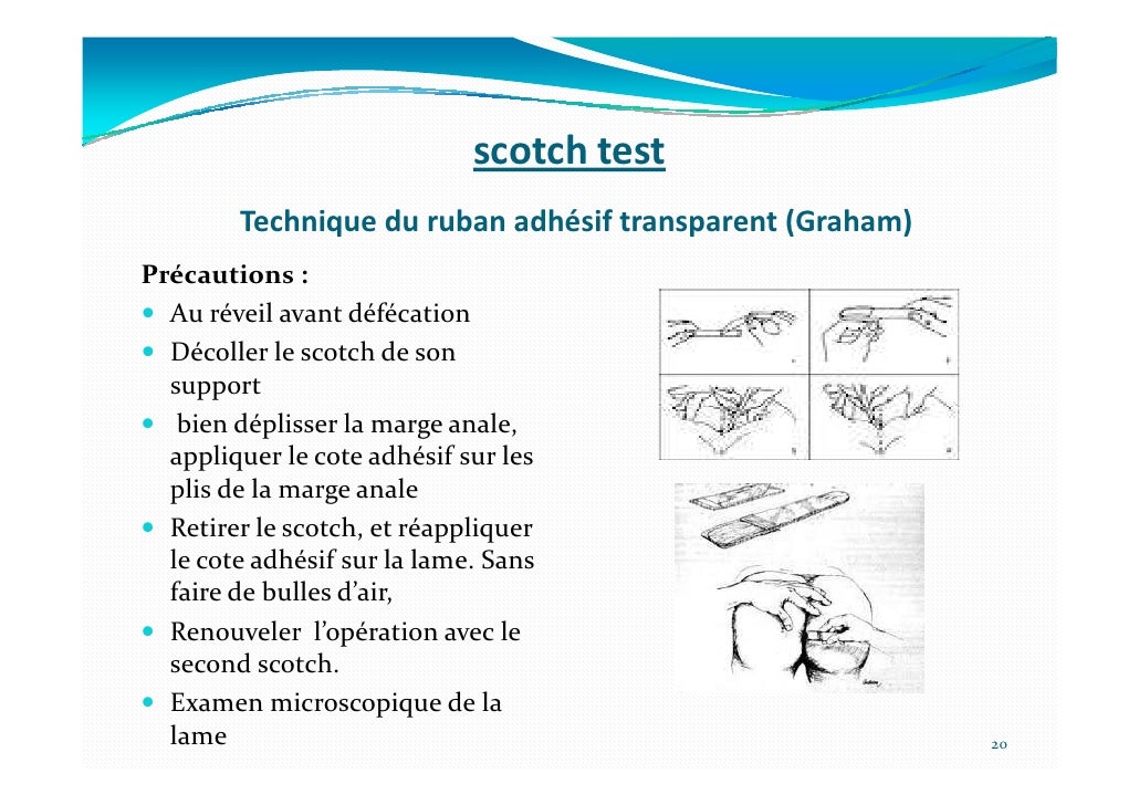 Ifmt 2012 p13 orientation clinique et diagnostic parasitologique des