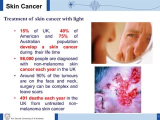 13
Skin Cancer
Treatment of skin cancer with light
• 15% of UK, 40% of
American and 75% of
Australian population
develop a skin cancer
during their life time
• 98,000 people are diagnosed
with non-melanoma skin
cancer each year in the UK
• Around 90% of the tumours
are on the face and neck,
surgery can be complex and
leave scars
• 491 deaths each year in the
UK from untreated non-
melanoma skin cancer
Ifor Samuel, University of St Andrews
 