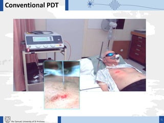 15
Conventional PDT
Ifor Samuel, University of St Andrews
 
