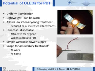 17Ifor Samuel, University of St Andrews
Potential of OLEDs for PDT
• Uniform illumination
• Lightweight - can be worn
• Allows low intensity/long treatment
– Reduced pain, increased effectiveness
• Low cost - disposable
– Attractive for hygiene
– Widens access to PDT
• Simple wearable power supply
• Scope for ambulatory treatment1
– At work
– At home
1. Moseley et al Brit. J. Derm. 154, 747 (2006)
 