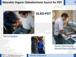 Ifor Samuel, University of St Andrews 18
Device Applied
Device Worn During
Normal Daily Activities
Device Disposed
Wearable Organic Optoelectronic Source for PDT
OLED-PDT
BioEL 2015, Kirchberg
Ifor Samuel, University of St Andrews
 