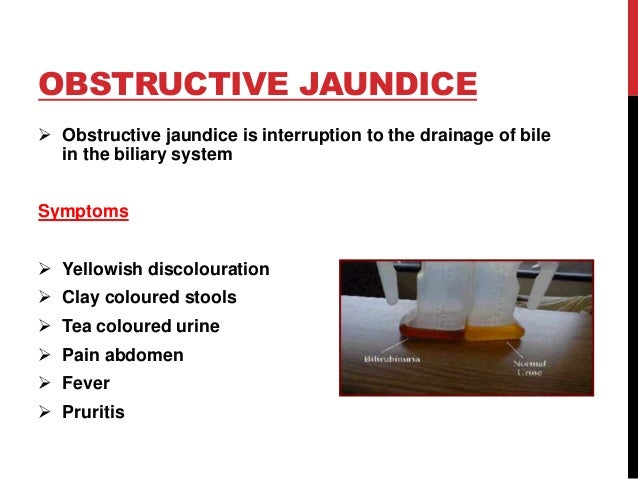 obstructive jaundice