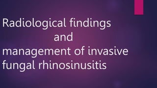 Radiological findings
and
management of invasive
fungal rhinosinusitis
 
