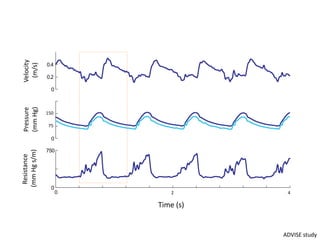 0
0.2
0.4
0
1
2
3
0 5 10
0
750
Velocity
(M-2)
Pressure
(mmHg)
Resistance
(mmHgM
-2
)
Time (s)
150
75
Resistance
(mmHgs/m)
Pressure
(mmHg)
Velocity
(m/s)
Time (s)
2 4
ADVISE study
 