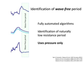 Fully automated algorithms
Identification of naturally
low resistance period
Uses pressure only
Wave-freeperiodWave-freeperiod
Sen S, Escaned J, Davies JE et al. JACC (in press 2011)
Davies JE et al. Circulation 2006;113:1767-1778
Davies JE et al. Circulation 2011;124:1565-1572
Identification of wave-free period
 