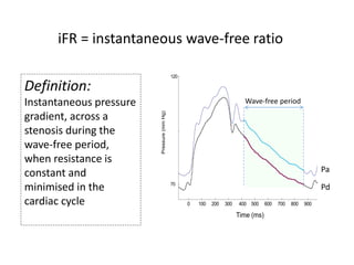 Definition:
Instantaneous pressure
gradient, across a
stenosis during the
wave-free period,
when resistance is
constant and
minimised in the
cardiac cycle
iFR = instantaneous wave-free ratio
Pa
Pd
0 100 200 300 400 500 600 700 800 900
70
120
Pressure(mmHg)
Time (ms)
Wave-free period
 