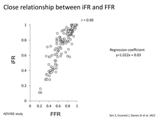 0
0.2
0.4
0.6
0.8
1
0 0.2 0.4 0.6 0.8 1
Close relationship between iFR and FFR
r = 0.90
y=1.022x + 0.03
Regression coefficient
FFR
iFR
ADVISE study
Sen S, Escaned J, Davies JE et al. JACC
 