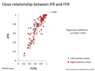 0
0.2
0.4
0.6
0.8
1
0 0.2 0.4 0.6 0.8 1
Close relationship between iFR and FFR
y=1.022x + 0.03
Regression coefficient
Left coronary artery
Right coronary artery
FFR
iFR
r = 0.90
ADVISE study
Sen S, Escaned J, Davies JE et al. JACC
 